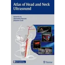  Atlas of Head and Neck Ultrasound – Heinrich Iro,Alessandro Bozzato,Johannes Zenk idegen nyelvű könyv