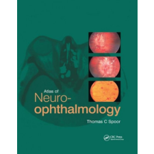 Atlas of Neuro-ophthalmology – Thomas C. Spoor idegen nyelvű könyv