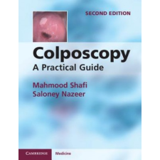 Colposcopy – Mahmood Shafi idegen nyelvű könyv