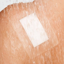  CURAPOR TRANSPARENT vízálló szigetkötszer 10x20cm gyógyászati segédeszköz