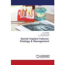  Dental Implant Failures: Etiology & Management – Leena Tomer,Chandani Agarsen idegen nyelvű könyv