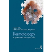  Dermatoscopy – Harald Kittler,Cliff Rosendahl,Alan Cameron,Philipp Tschandl idegen nyelvű könyv