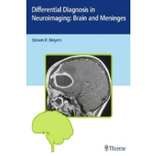 Differential Diagnosis in Neuroimaging: Brain and Meninges – Steven P. Meyers idegen nyelvű könyv