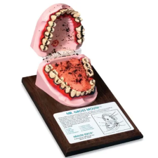  Dohányos száj - Mr. Gross Mouth W43013 gyógyászati segédeszköz