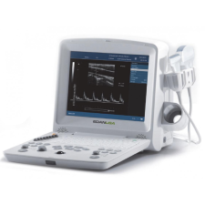  EDAN DUS60 ultrahang készülék gyógyászati segédeszköz