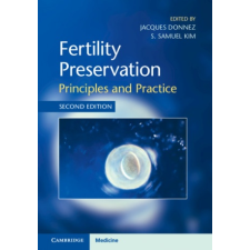  Fertility Preservation – Jacques Donnez,S. Samuel Kim idegen nyelvű könyv