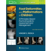  Foot Deformities and Malformations in Children
