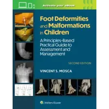  Foot Deformities and Malformations in Children idegen nyelvű könyv