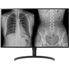 LG 32HL512D-B monitor