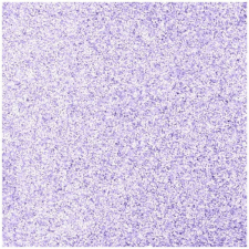 Pentart Öntapadós glitteres / csillámos dekorgumi, 20cm x 30cm világoslila dekorgumi