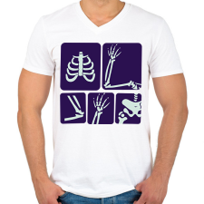 PRINTFASHION Röntgen - Férfi V-nyakú póló - Fehér férfi póló