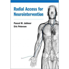  Radial Access for Neurointervention idegen nyelvű könyv