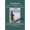  Scoliosis: Revised Edition: Causes, Symptoms, Signs, Diagnosis and Treatments – Institutes of Health National Institute,S Smith,S Smith
