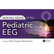 Taylor &amp; Francis Ltd Making Sense of the Pediatric EEG | Maria Montenegro egyéb könyv