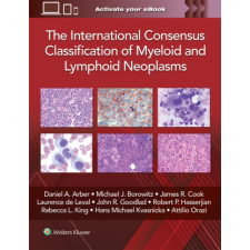The International Consensus Classification of Myeloid and Lymphoid Neoplasms idegen nyelvű könyv