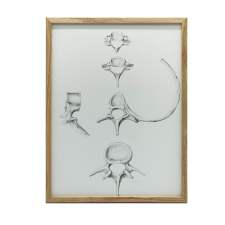  VÁSZONFESTÉS ANATÓMIAI GERINCS C6 C7 TH5 L4 VÁSZON 50x70CM grafika, keretezett kép