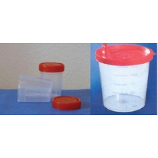  Vizeletes pohár, csavaros fedővel. gyógyászati segédeszköz